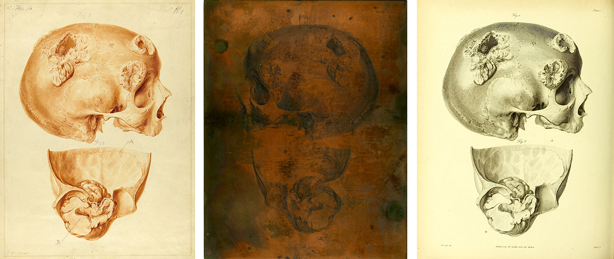 Watercolour drawing in orange pigment showing a skull in profile and part of the inside of the cranium. The skull faces right. | A copper plate engraved with an image of a skull in profile and part of the inside of the cranium. The skull faces left. | Engraved image printed in black showing a skull in profile, and part of the inside of the cranium. The skull faces right.