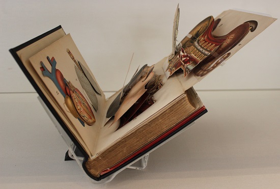 A book with lifting flaps, shown mounted in the case. You can see the anatomy of the head.