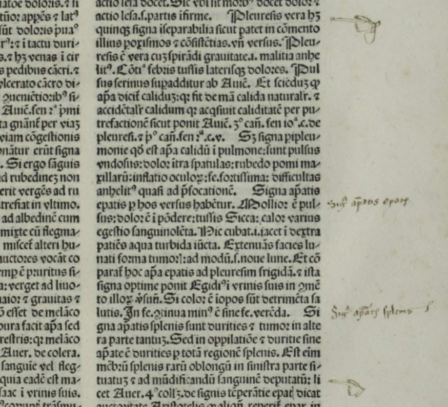 Marginalia next to Latin text describing on cancer and apostema:, cysts or abscesses. 