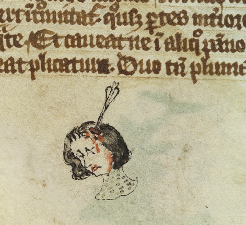Detail of a manuscript showing a man with an arrow piercing his head. Courtesy of the Wellcome Collection.