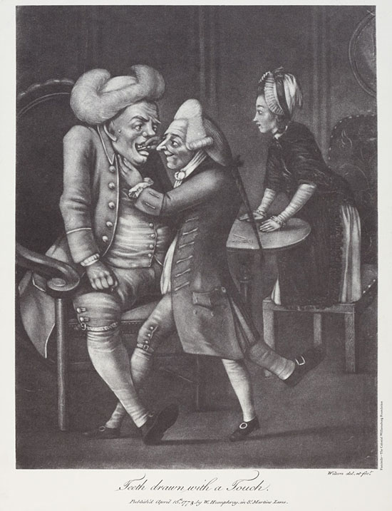 An engraved cartoon of an 18th century man having teeth pulled.